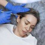 Micro-Needling Works With PRP in Los Angeles